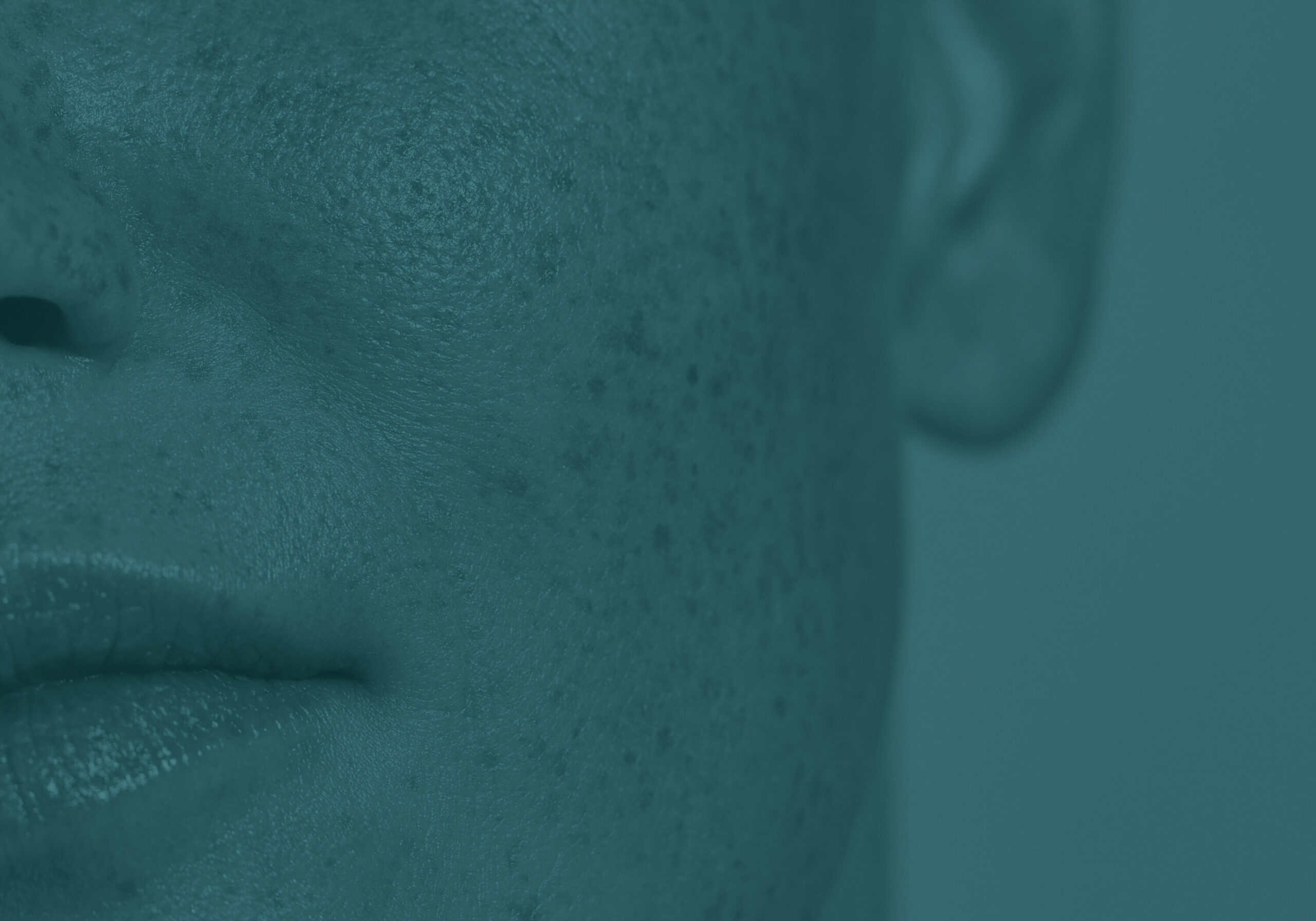 Behandlungen für eine schöne Haut